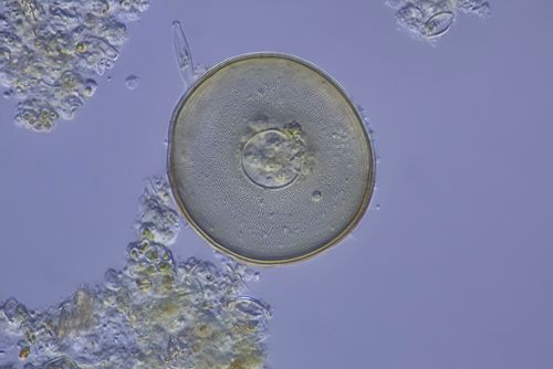 http://commons.wikimedia.org/wiki/File:Mikrofoto.de-arcella\_3.jpg